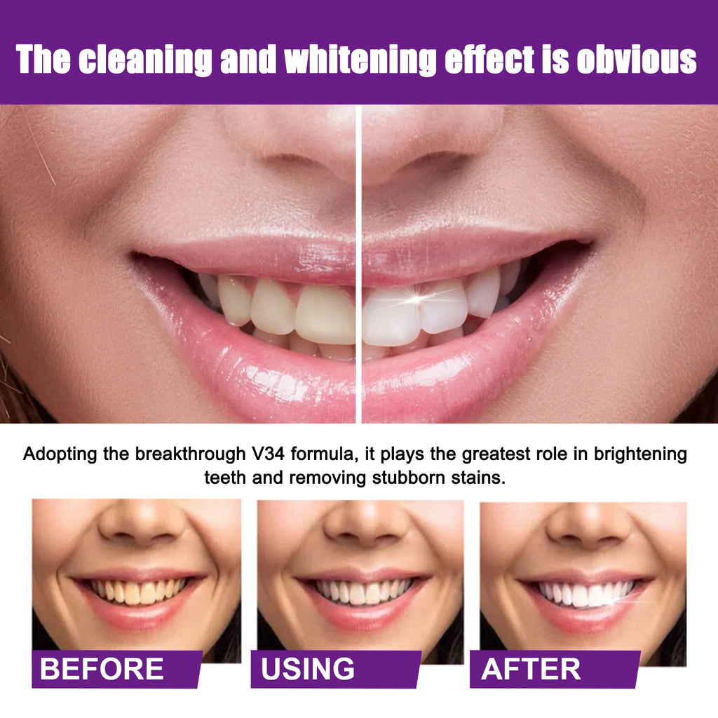 Premium Purple Brightening Toothpaste, Removes Surface Stains & Oral Odor, Gentle Gum Care, Daily Brightening & Refreshing Teeth Zpaxo