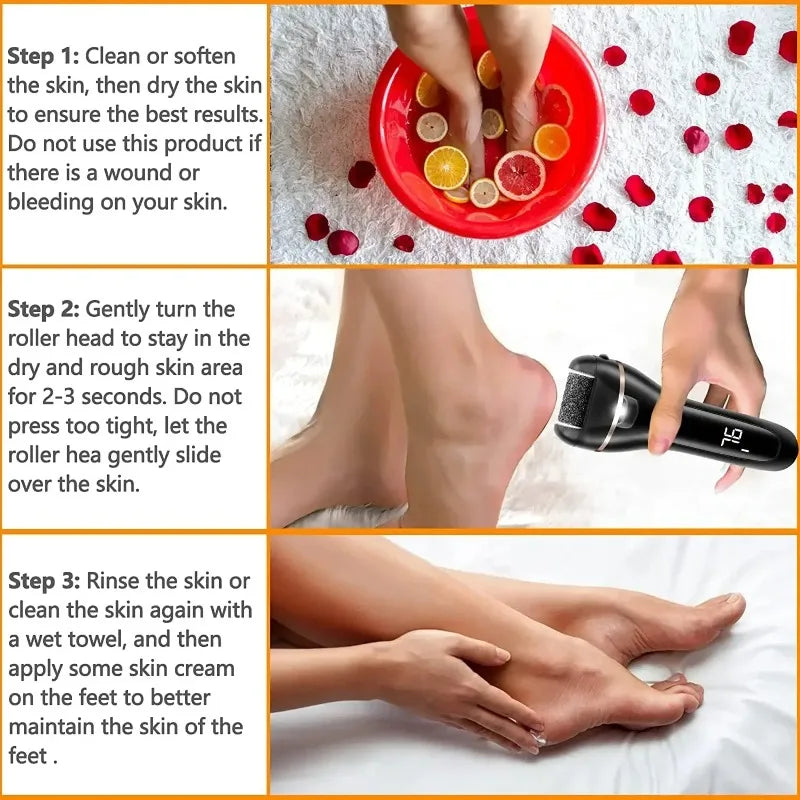 Electric Foot Callus Remover – 18-in-1 Rechargeable Pedicure Kit Electric Callus Remover Zpaxo