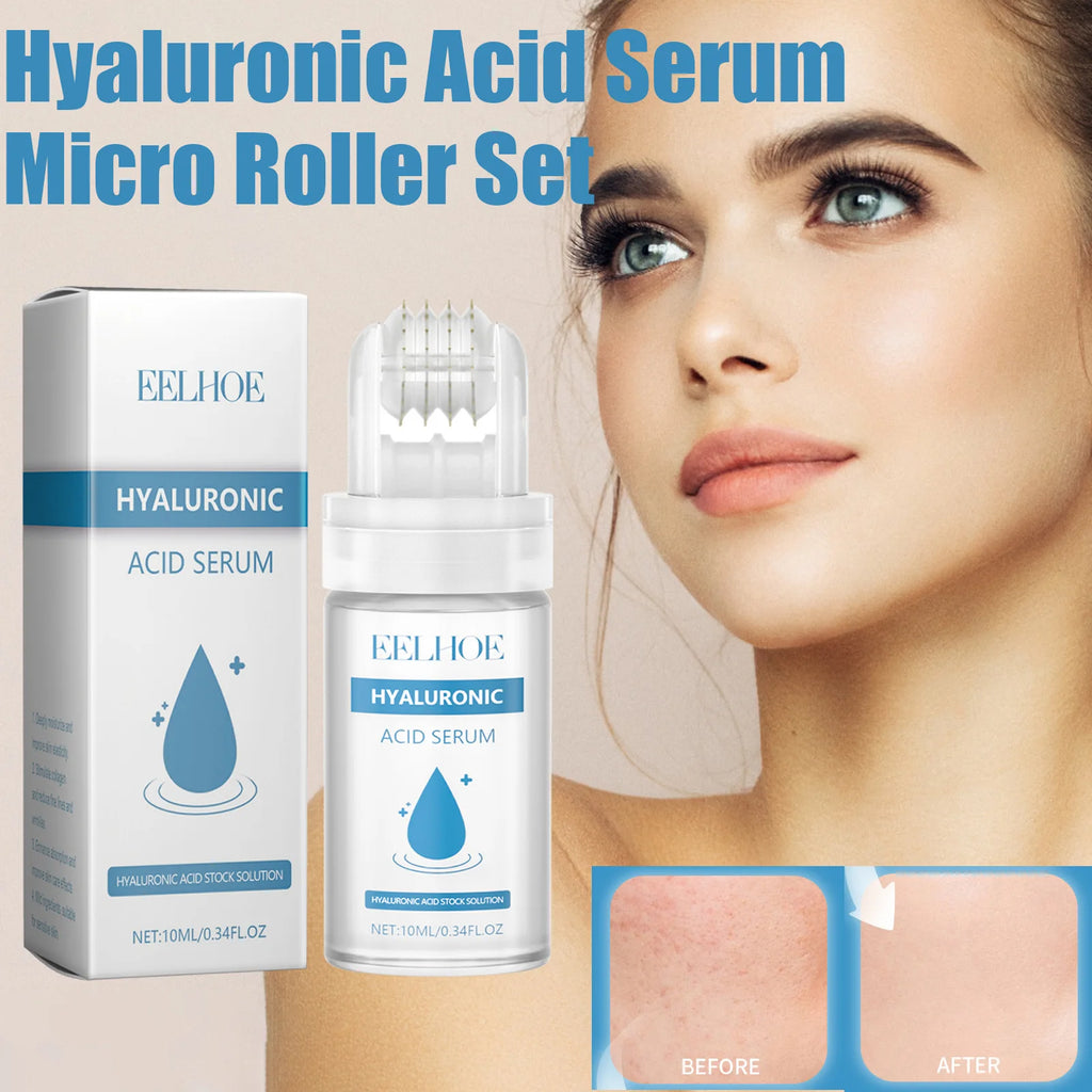 Hyaluronic Acid Serum Micro Roller 0.25mm Micro Needle Essence Hydrating Brightening Smooth Pore Refining Beauty Facial Skin Car Zpaxo