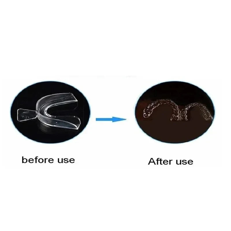 Transparent EVA Sports Mouthguard – MMA, Boxing & Martial Arts