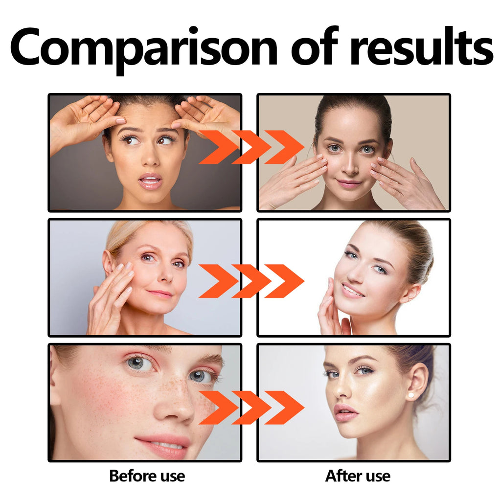 Vitamin C Face Serum 30ml Brightening, Anti Aging Tightens Minimizes Pores Hydrating Firming Essence for Fine Lines Dull Skin Zpaxo