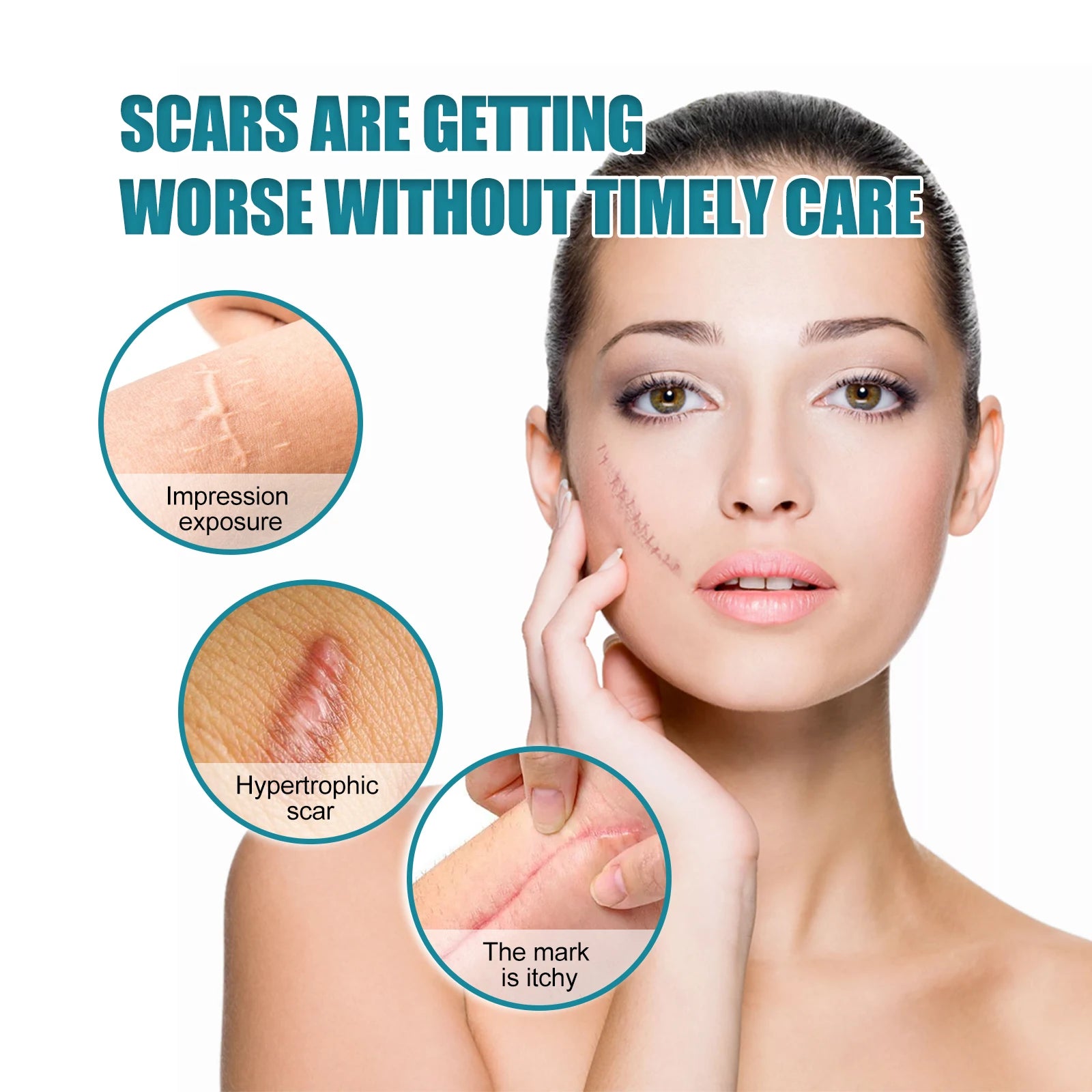 1 Roll Silicone Scar Sheets , 4cmX150cm Self-Adhesive Scar Cover Tape Reusable and Effective Skin Care Strips Zpaxo