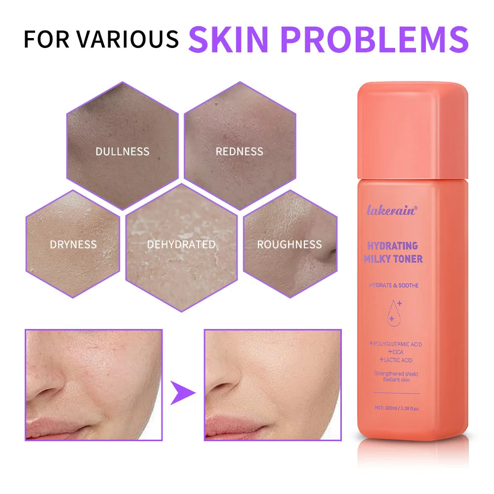 Hydrating Milky Toner – Barrier Repair & Moisture-Lock for Face Hydrating Face Toner Zpaxo