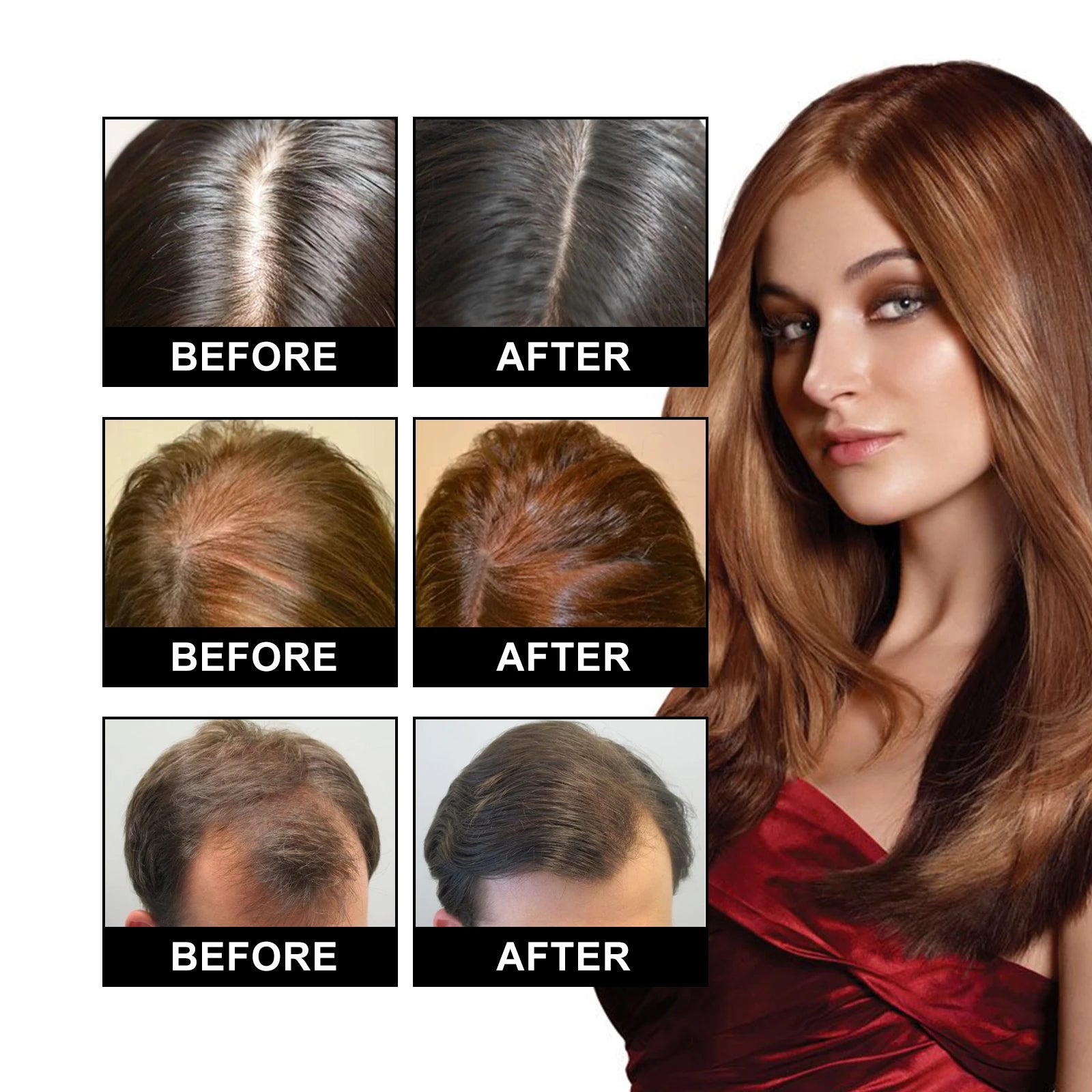 Ouhoe Hair Care Oil for Thinning Hair Scalp Treatment Serum to Strengthen Roots and Repair Damaged Hair 30ml Natural Formula Zpaxo