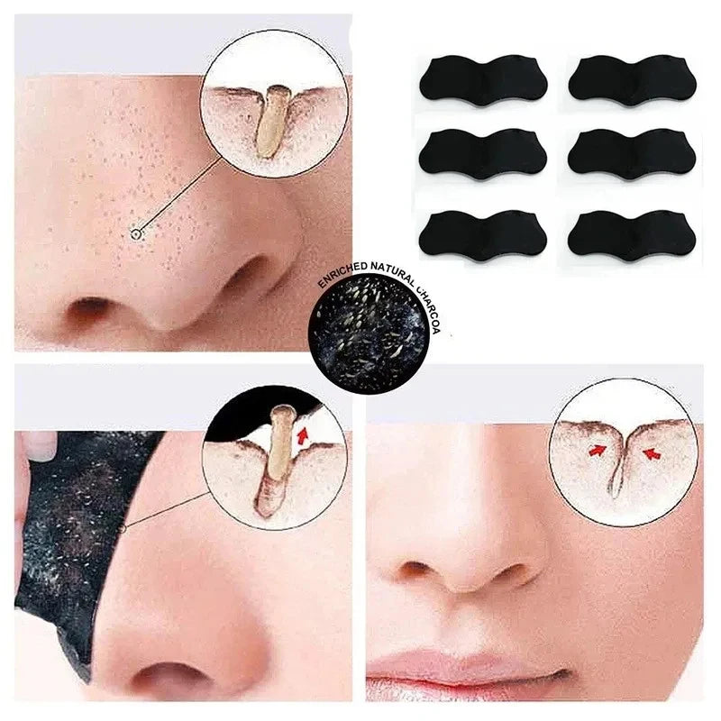 Blackhead Remover Nose Strips – Pore Cleansing Patches 10/40/100