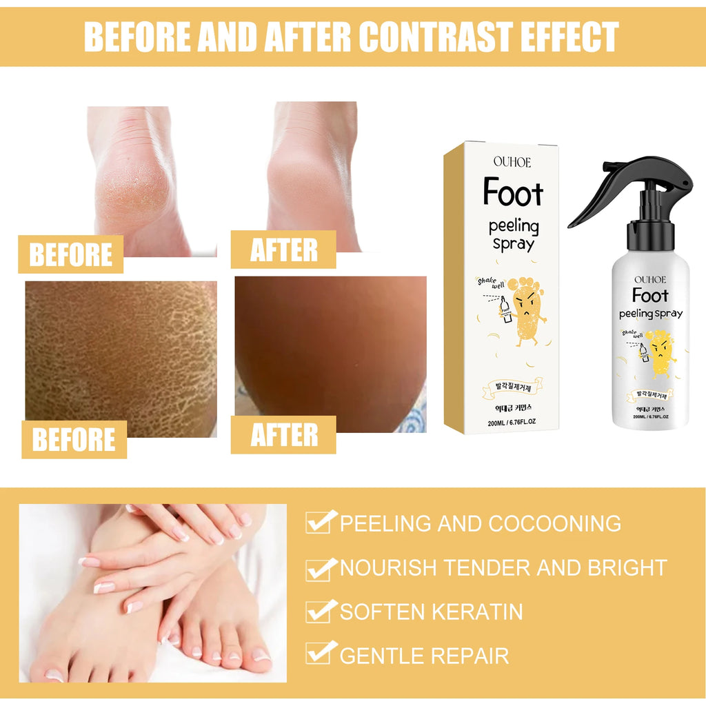Ouhoe Foot Exfoliating Spray 72H Moisture Lock Callus Softener Anti Dry Crack Repair Odor Control Brightening Foot Care Liquid Zpaxo