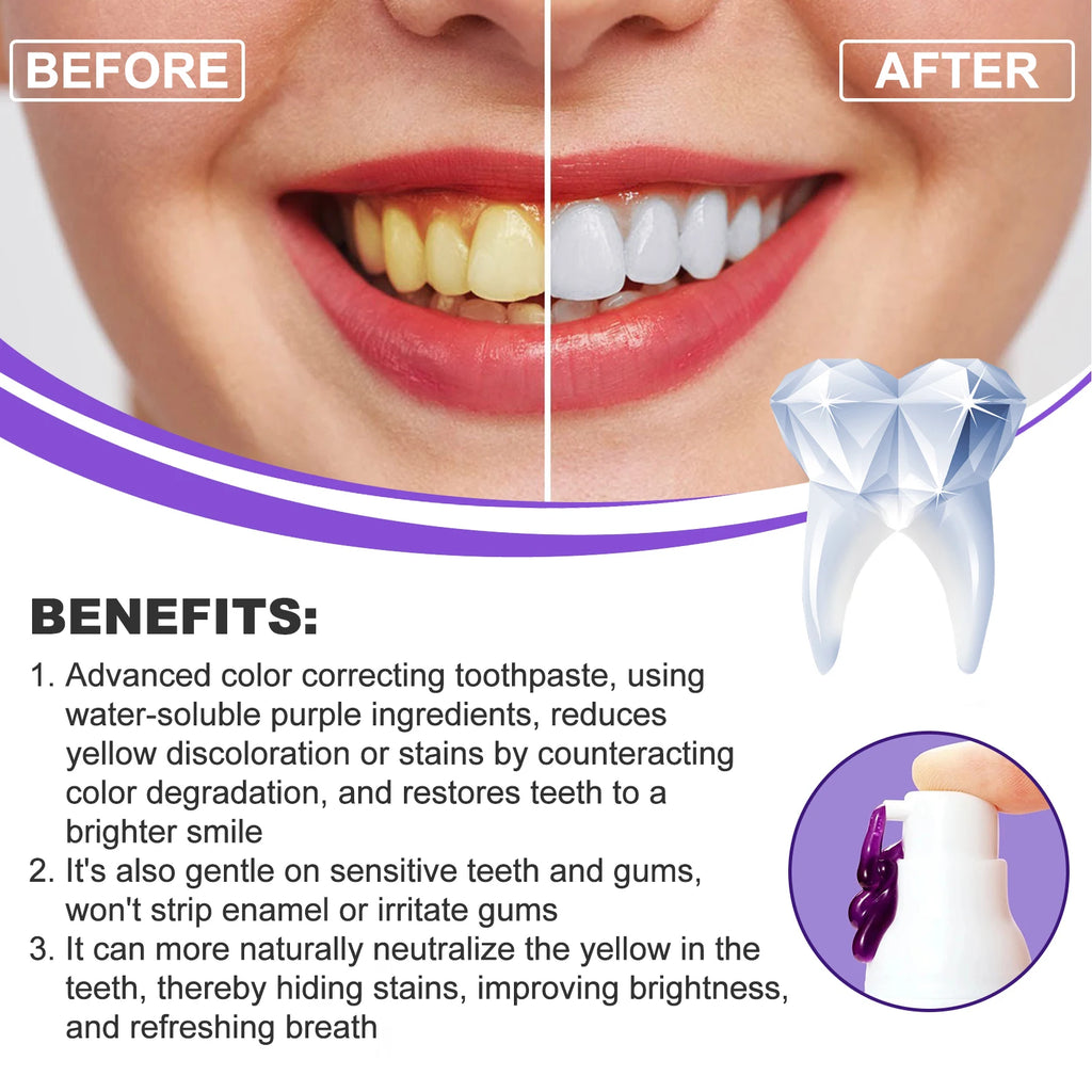 EELHOE Smiles Bright White Refining Serum Teeth Whitening Mousse Mild Ingredients Nano-Hydroxyapatite Xylitol Easy To Use 30ml Zpaxo