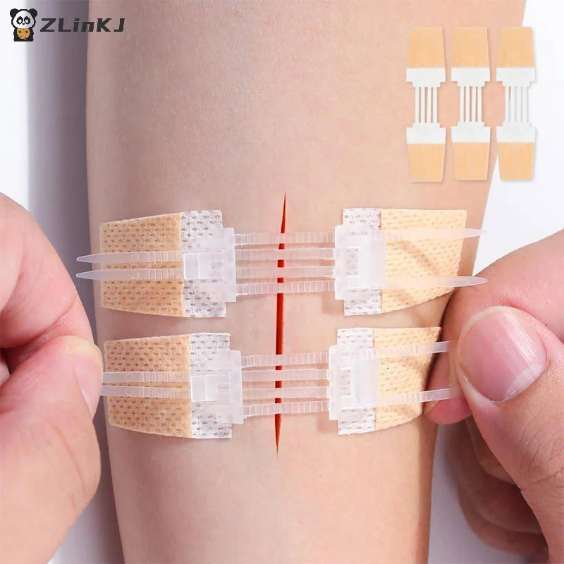 Zipper Band-aid Painless Wound Closure Patch Suture-free Dressing Zpaxo