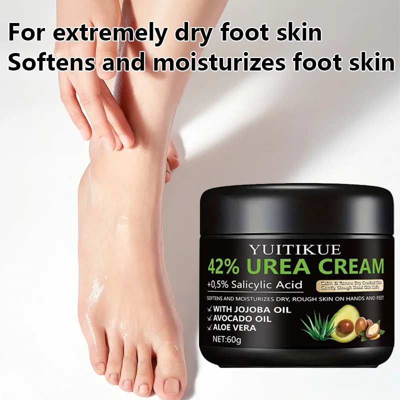 Urea Foot Cream – Repair Cracked Heels & Moisturize Dry Skin Foot Cream Zpaxo
