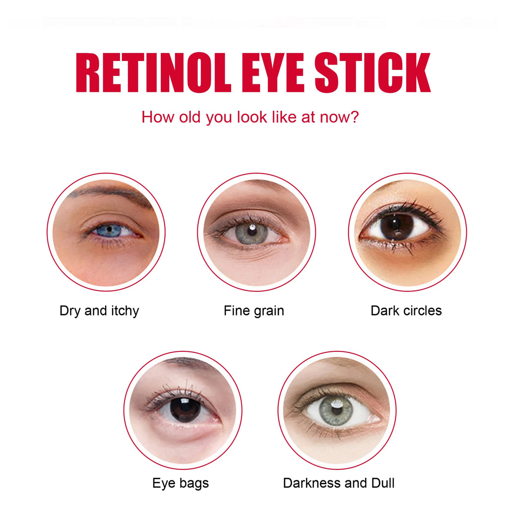 Retinol Eye Stick Anti-Wrinkle Lifting Firming Eye Cream Stick for Dark Circles & Fine Lines Moisturizing Brightening Skin Care Zpaxo
