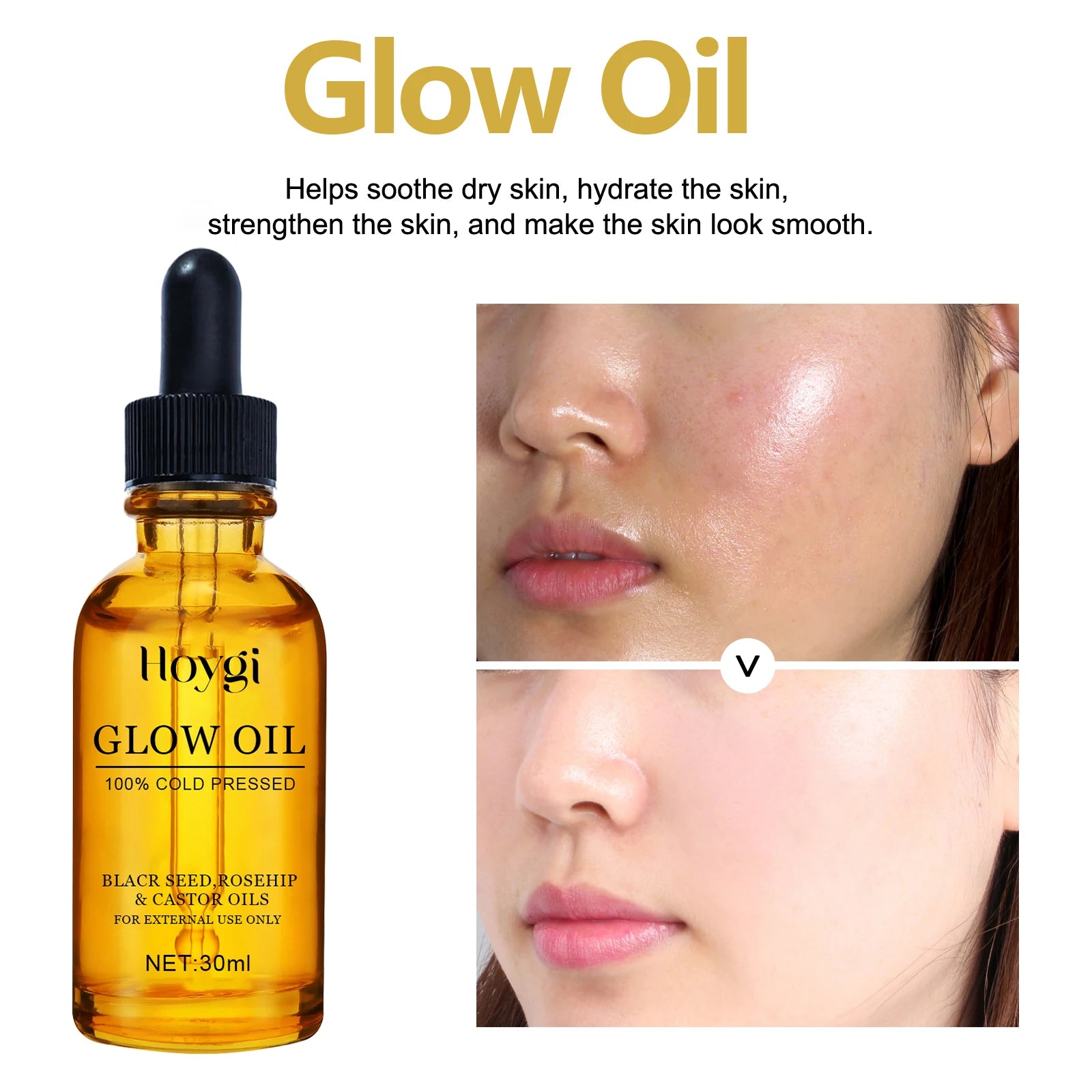 Facial Oil Anti Aging Face Treatment Hydrating Moisturizer Wrinkle Reducer for Dry Skin Rosehip Oil Brightening 30ml Non Greasy Zpaxo