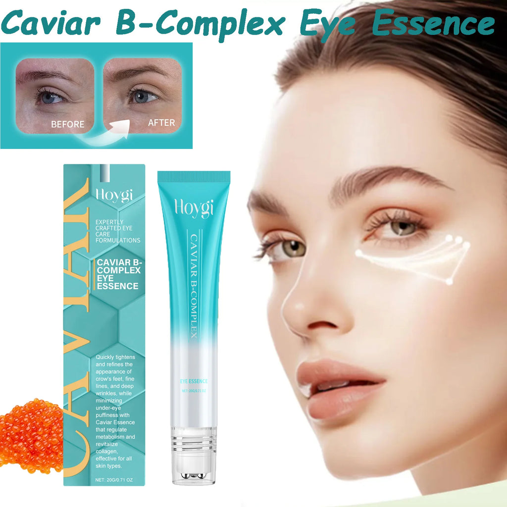 Hoygi Caviar Eye Serum – Dark Circles & Puffiness Relief Eye Serum Zpaxo