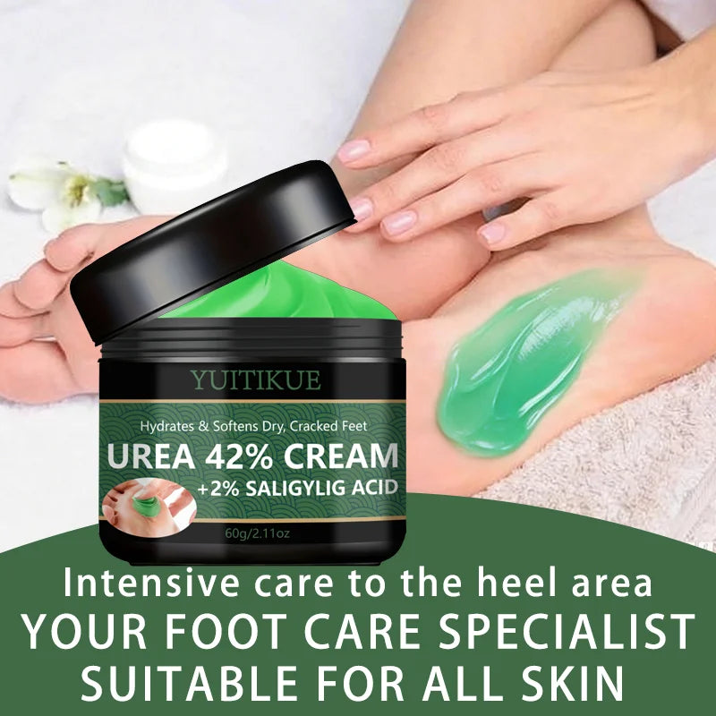 YUITIKUE 42% Urea Foot Cream – Callus & Dry Skin Relief Urea Foot Cream Zpaxo