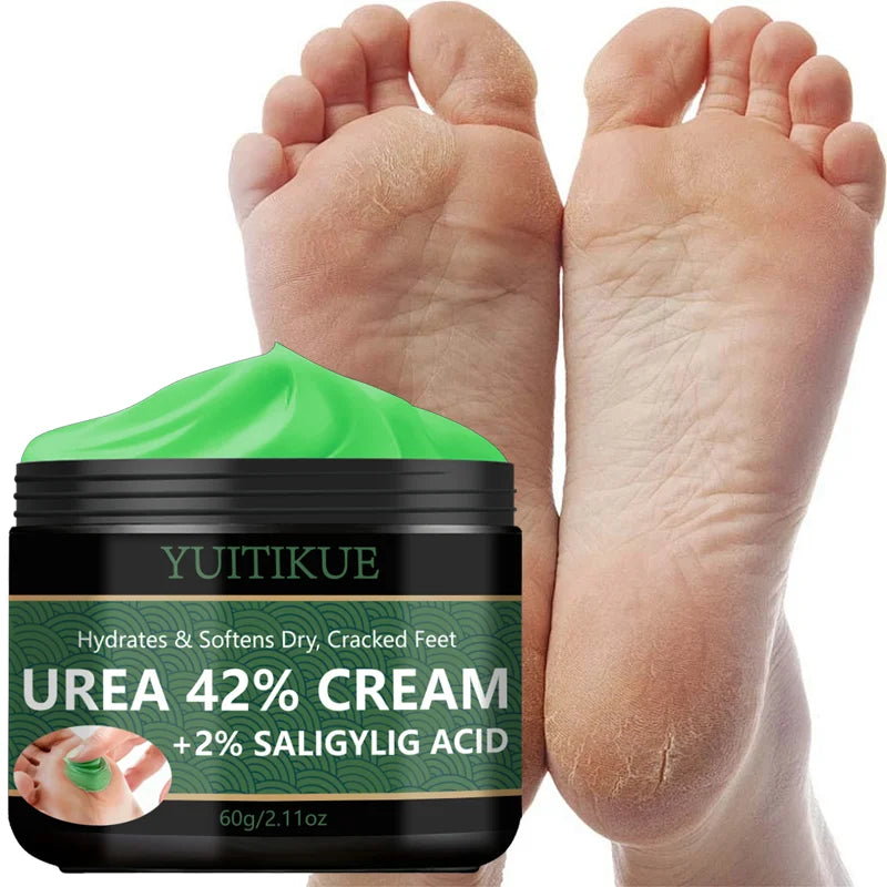 YUITIKUE 42% Urea Foot Cream – Callus & Dry Skin Relief Urea Foot Cream Zpaxo