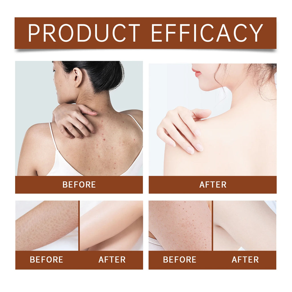 Luxury Body Oil for Dry Skin Argan Oil & Sweet Almond Oil Nourishing Glowing Skin Lightweight Non Greasy Winter Skincare Gift Zpaxo