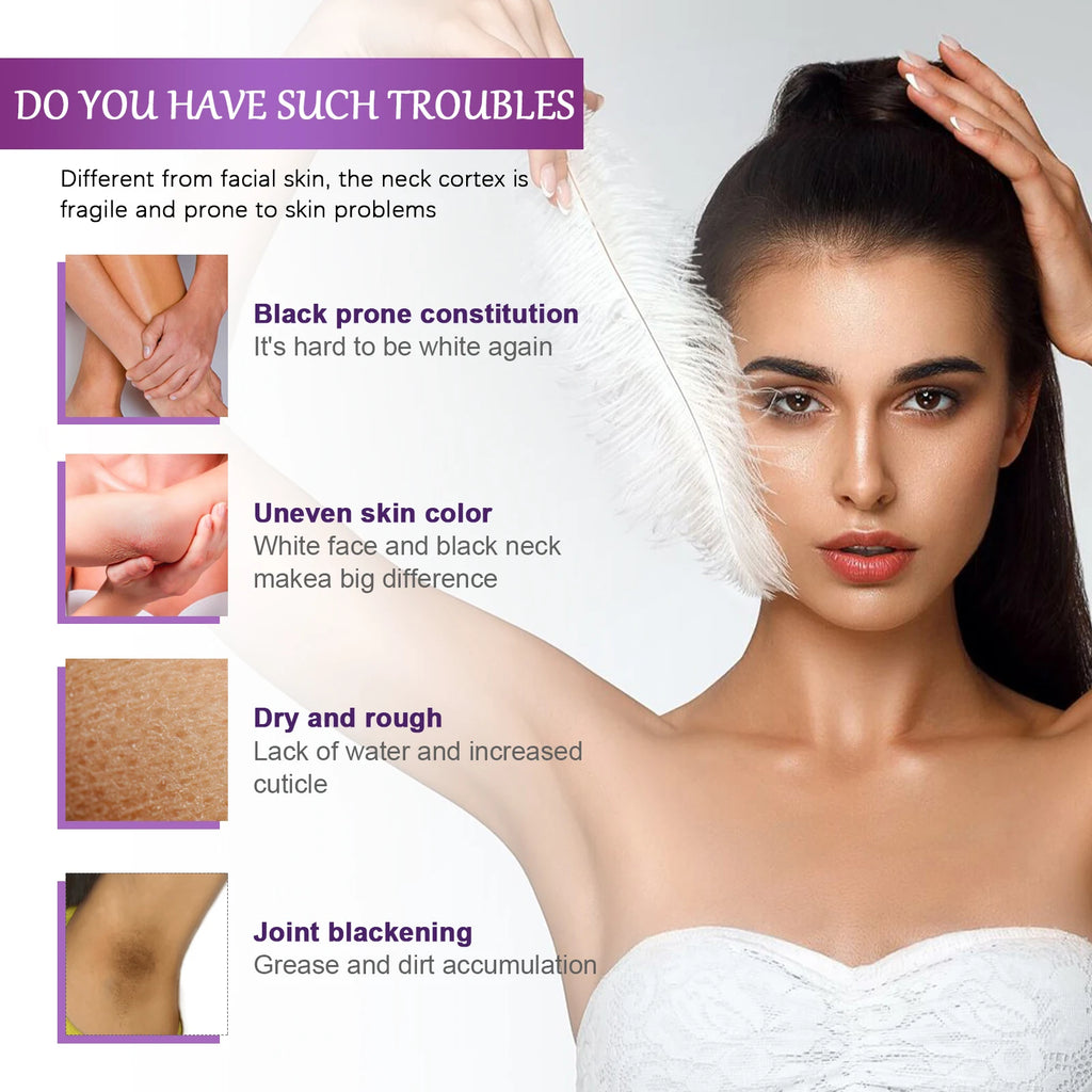 Remove Melanin Nicotinamide Brightening Cream Dark Skin Effective Zpaxo