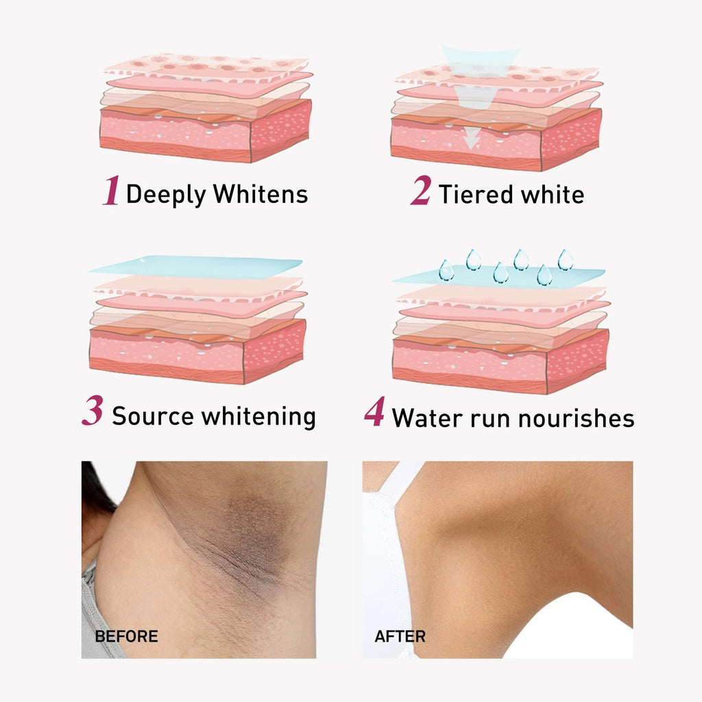 Eelhoe Skin Lightening Cream – Underarm & Body Brightener 60ml Skin Brightening Cream Zpaxo
