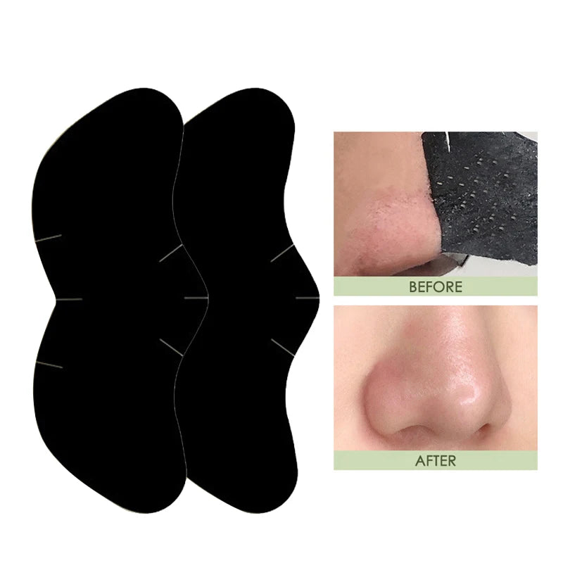 Blackhead Removal Nasal Patch - Nasal Cleansing Mask, Deep Cleansing, Gentle, Suitable for Both Men and Women for Removing Black Zpaxo