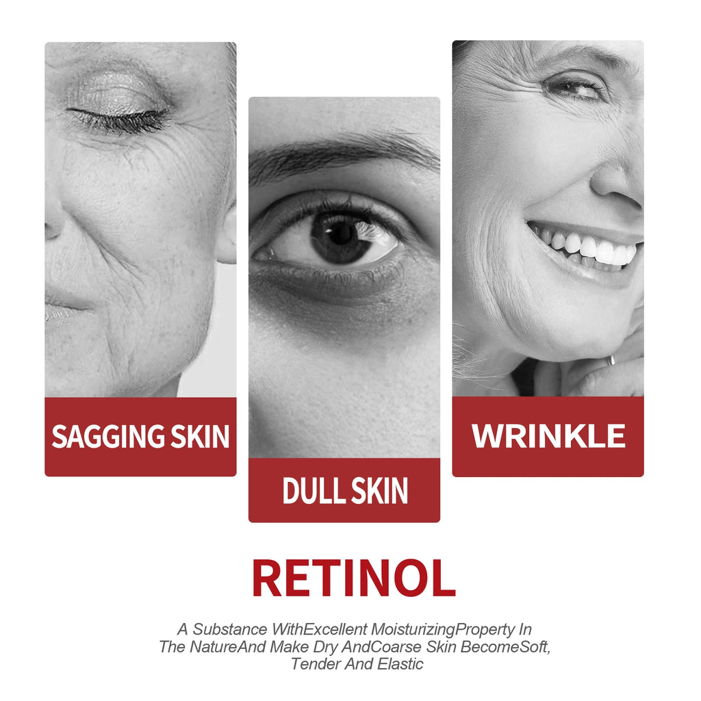 OUHOE Retinol Moisturizing Cream Anti-Wrinkle Fade Fine Lines Dark Circles Pore Tightening Moisturizing Anti-Aging Cream Zpaxo