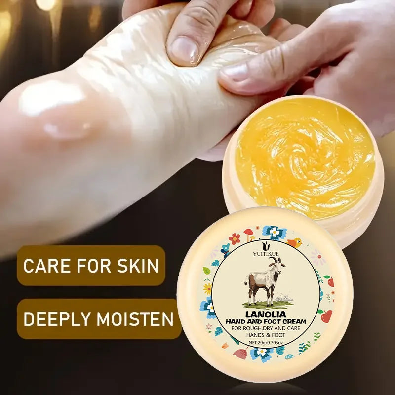 YUITIKUE Lanolin Hand & Foot Cream – Repairs Dry Cracked Skin 20g Hand & Foot Cream Zpaxo