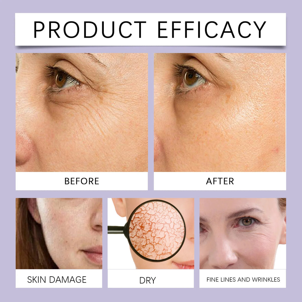 Hoygi Wrinkle Reducing Skin Overnight Toning Tightening Cream Body Firming Improve Skin Sagging and Fine Lines Natural Ingredien Zpaxo