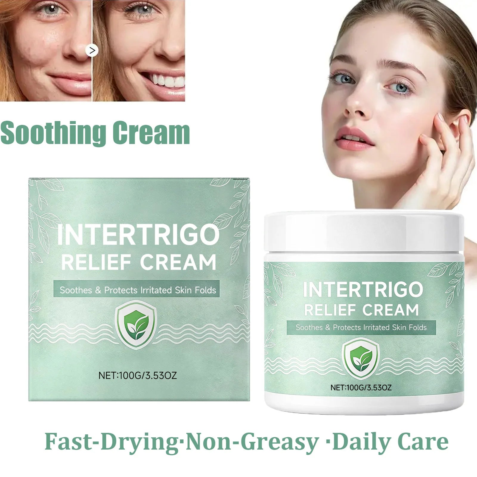 Hoygi Skin Fold Soothing Cream – Intertrigo Relief 100g Skin Barrier Cream Zpaxo
