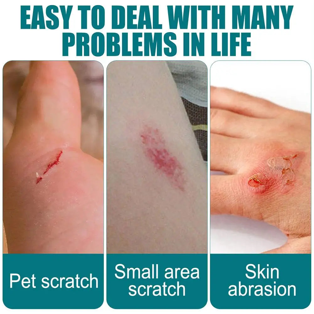 Waterproof Liquid Bandage Wound Healing Gel Spray | Breathable Liquid Bandage Gel Zpaxo