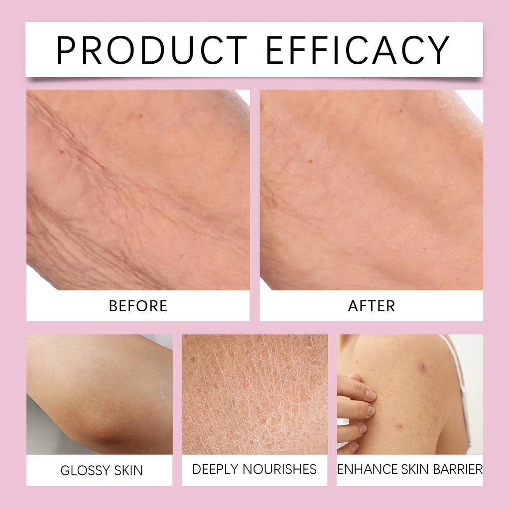 237ml Moisturizer Body Cream for Dry Skin Remedy Vanilla Coconut Rose Deep Hydration Lock tighten whipped Firming Champagne Zpaxo