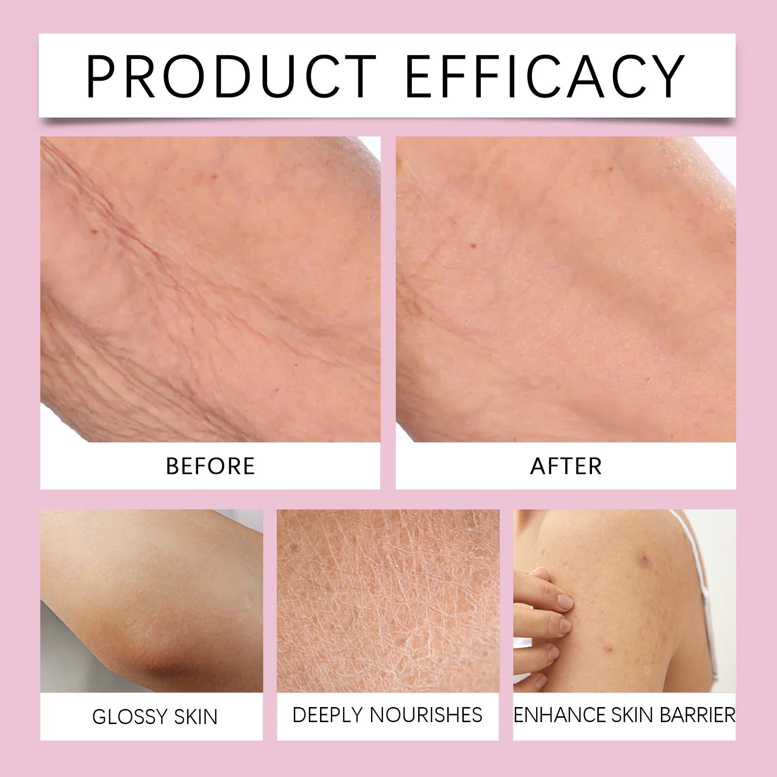 237ml Moisturizer Body Cream for Dry Skin Remedy Vanilla Coconut Rose Deep Hydration Lock tighten whipped Firming Champagne Zpaxo