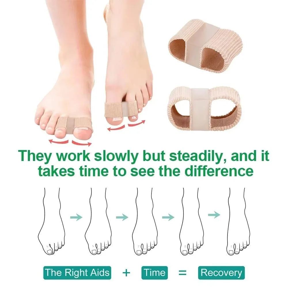 Silicone Two Toe Separator Adjuster Straightener Bunion Hallux Valgus Corrector Effective Thumb Finger Correction Foot Care Tool Zpaxo
