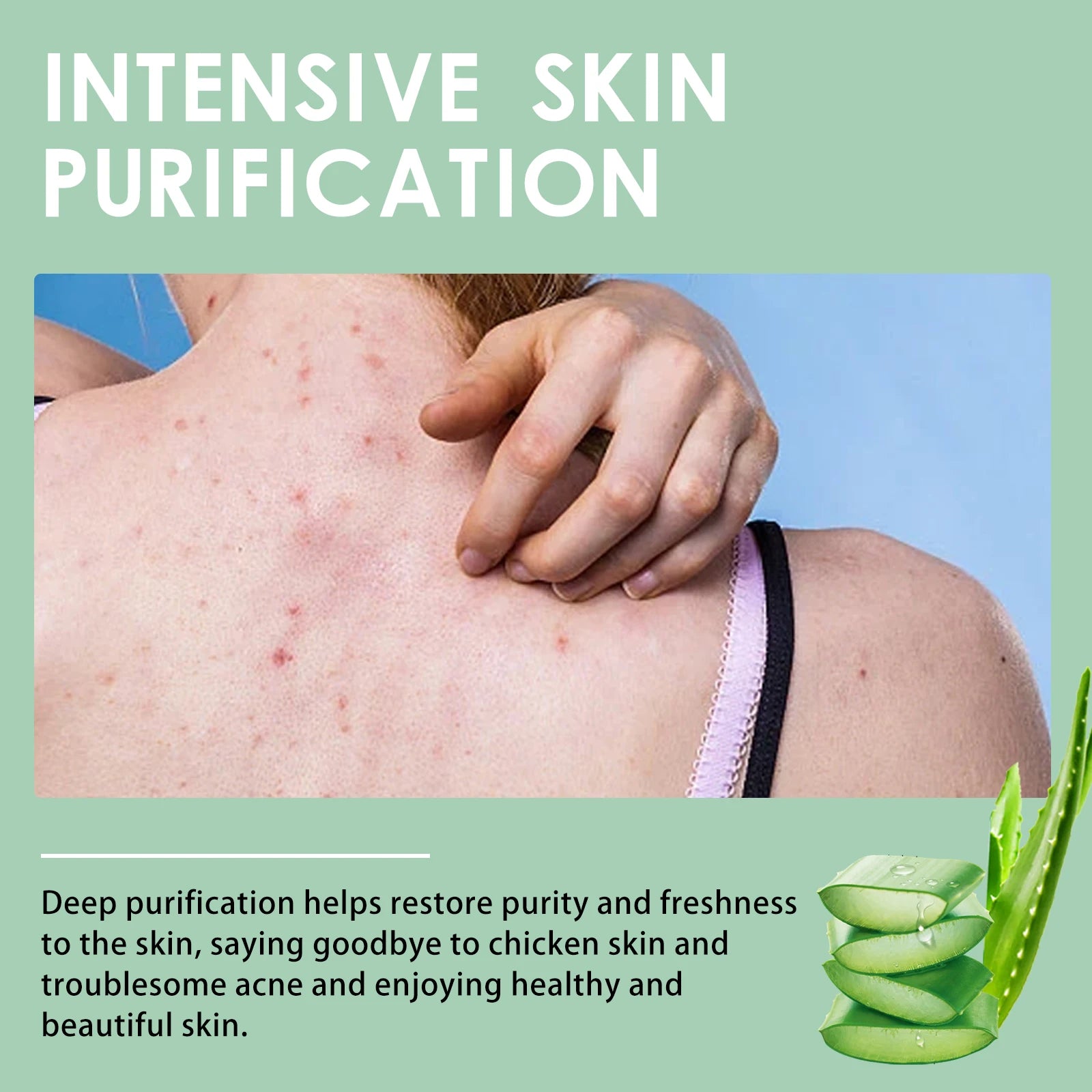 Chicken Skin Repair Cream Curing Body Keratosis Pilaris Remove Acne Sp-ot Rough Bumpy Pore Moisturizing Smooth Whi-tening Lotion Zpaxo