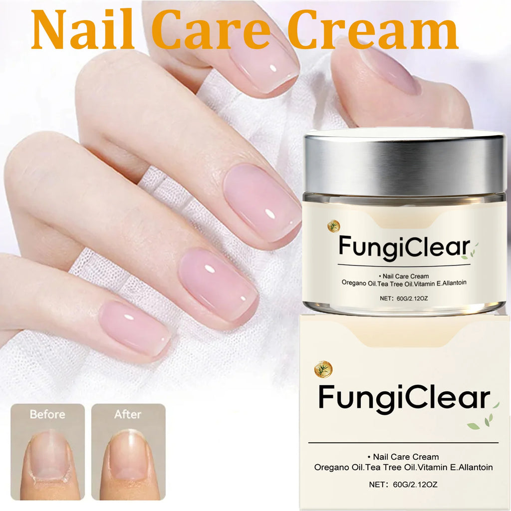Eelhoe Nail Care Cream – Strengthens Brittle Nails & Cuticles Nail Treatment Cream Zpaxo