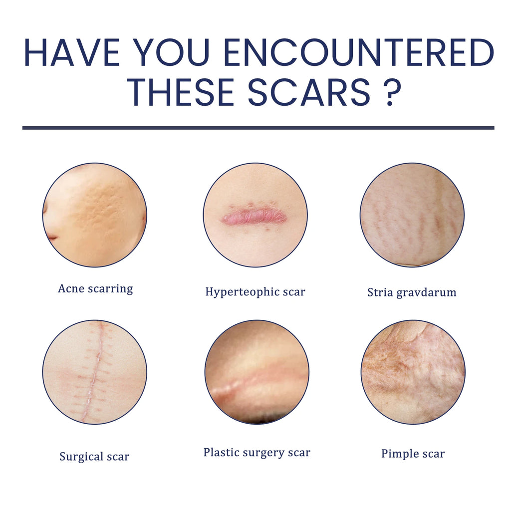 EELHOE Silicone Skin Scar Gel Retinol Niacinamide Scars Stretch Marks Burn Marks Deeply Nourish Skin Reduce Redness Swelling 30g Zpaxo