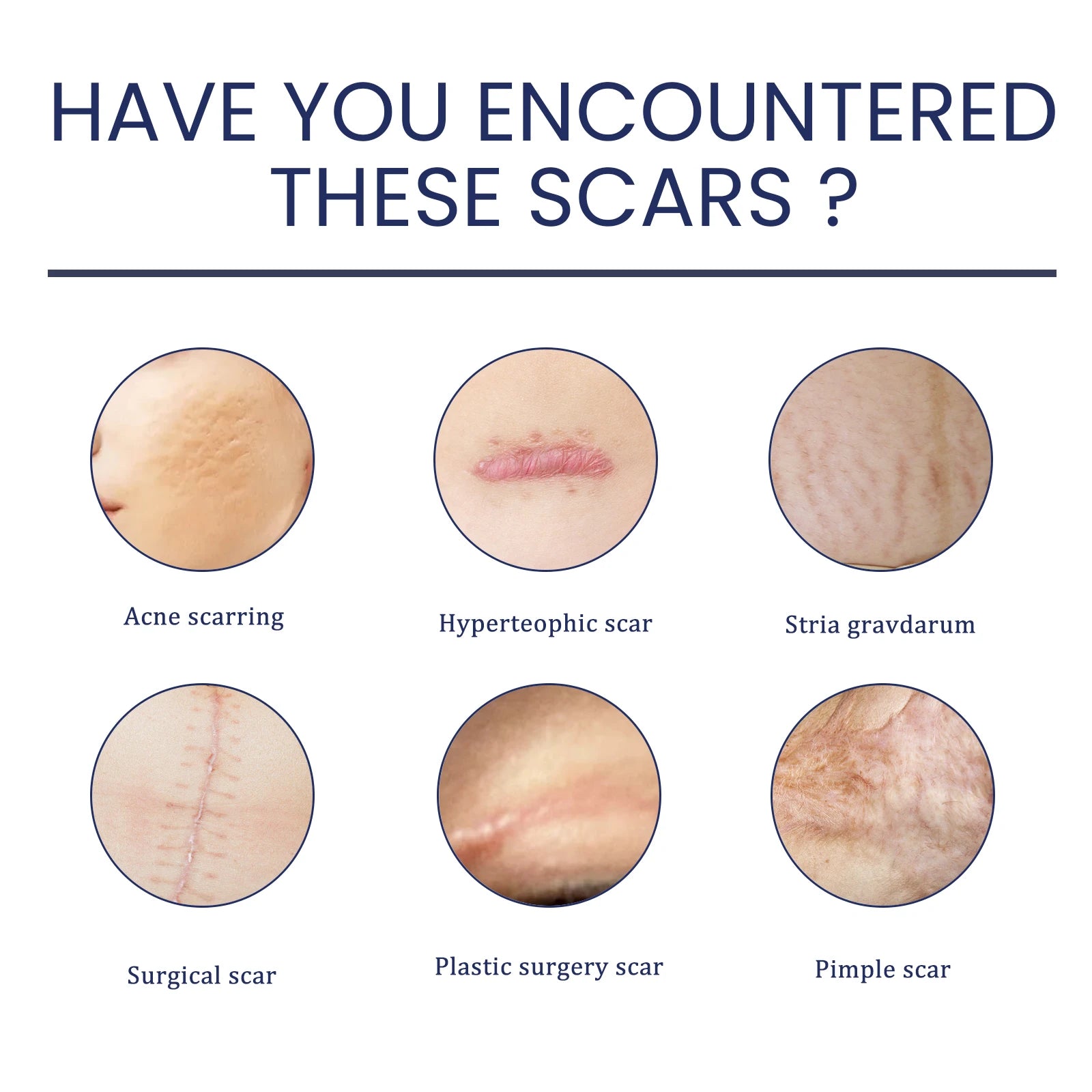 EELHOE Silicone Skin Scar Gel Retinol Niacinamide Scars Stretch Marks Burn Marks Deeply Nourish Skin Reduce Redness Swelling 30g Zpaxo