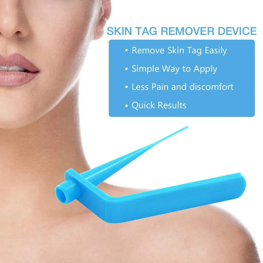 1 Set Skin Tag Removal Kit Skin Mole Wart Remover Micro Band Skin Tag Removal Kit Tag Treatment Tools Set with Cleansing Swabs Zpaxo