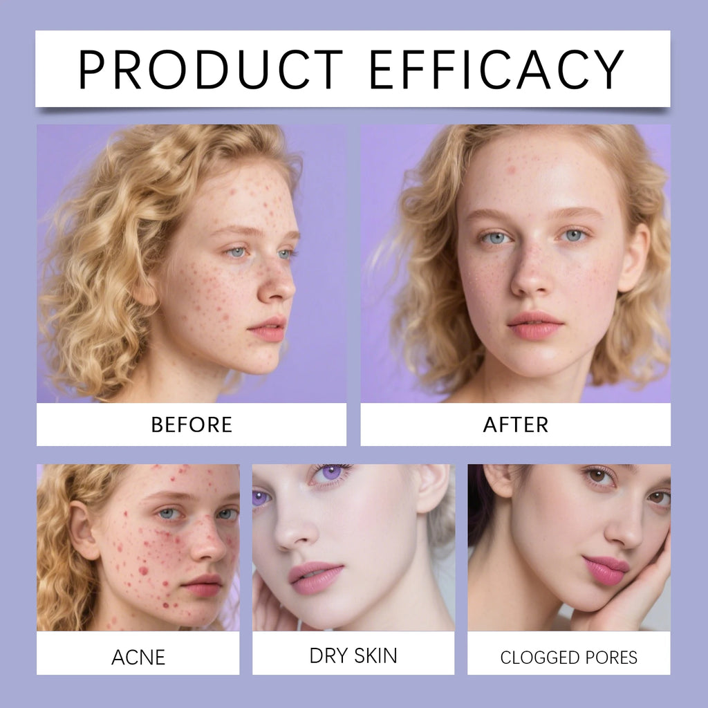 Star Acne Patches 240pcs Salicylic Acid Hydrocolloid Invisible Pimple Patches for Face Spot Treatment Ultra-Thin Gentle Care Zpaxo