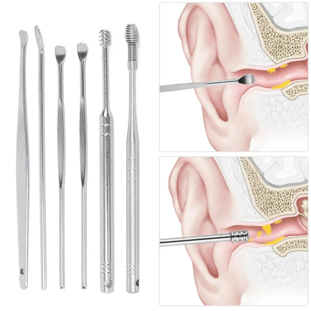 Stainless Steel Ear Wax Pickers Spiral Head Smooth Polished Earwax Zpaxo