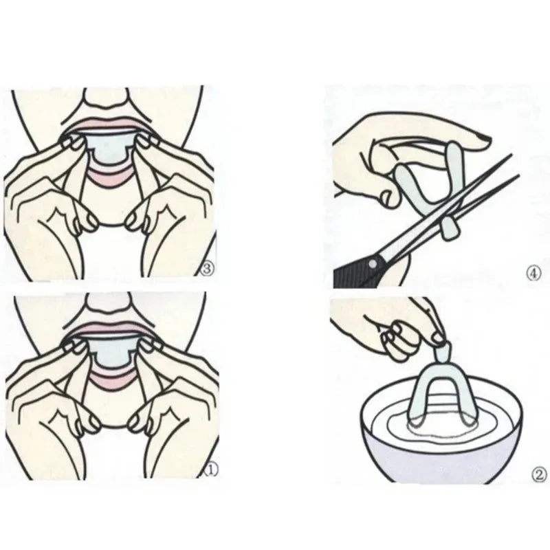 Silicone Mouth Guard Tray Set – Night Guard & Teeth Whitening