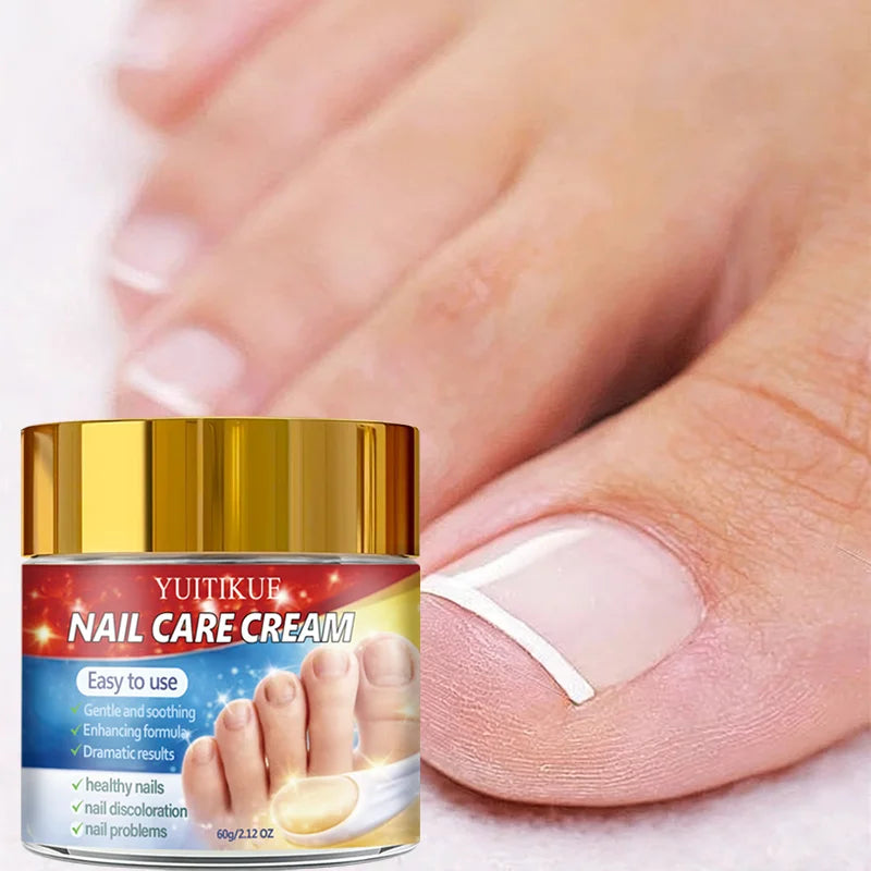 YUITIKUE Nail Repair Cream – Retinol & Collagen Formula 60g Nail Repair Cream Zpaxo