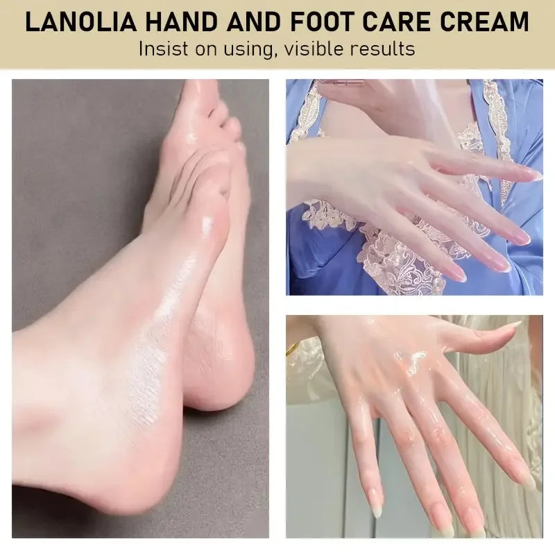 YUITIKUE Lanolin Hand & Foot Cream – Repairs Dry Cracked Skin 20g Hand & Foot Cream Zpaxo