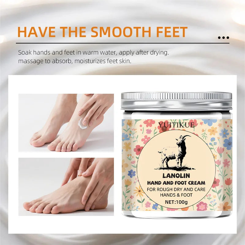 YUITIKUE Lanolin Hand & Foot Cream 100g – Dry Skin Relief Hand & Foot Cream Zpaxo