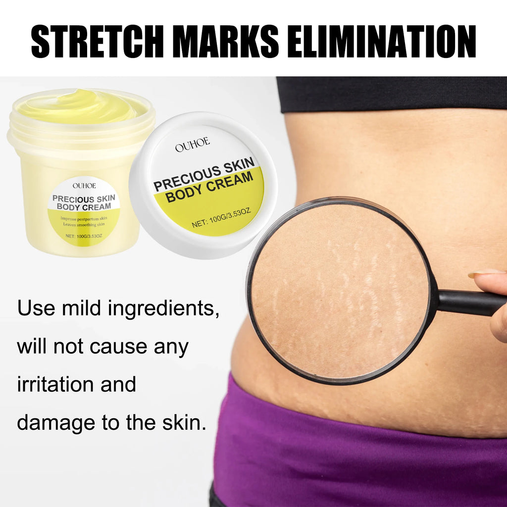 OUOHE Pregnancy Care Cream Moisturizes Repairs Fine Lines Postpartum Zpaxo