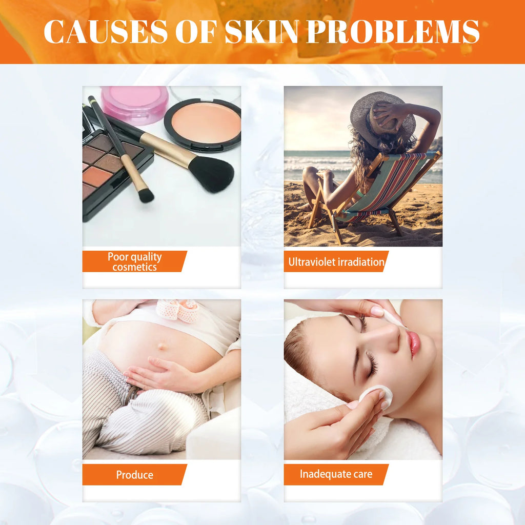 Papaya Day & Night Face Cream Set – Dark Spot & Freckle Corrector Brightening Face Cream Zpaxo