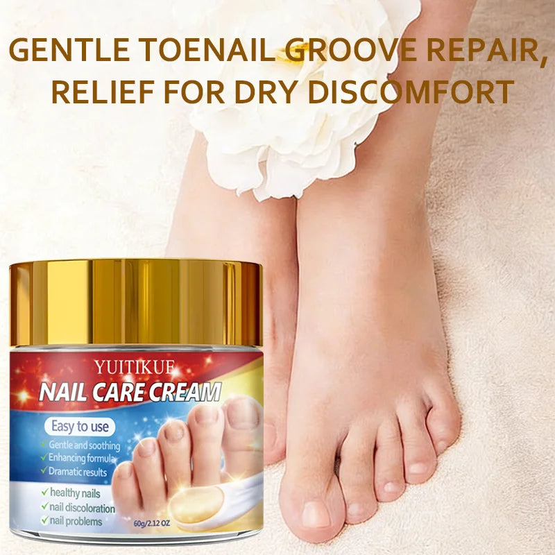 YUITIKUE Nail Repair Cream – Retinol & Collagen Formula 60g Nail Repair Cream Zpaxo