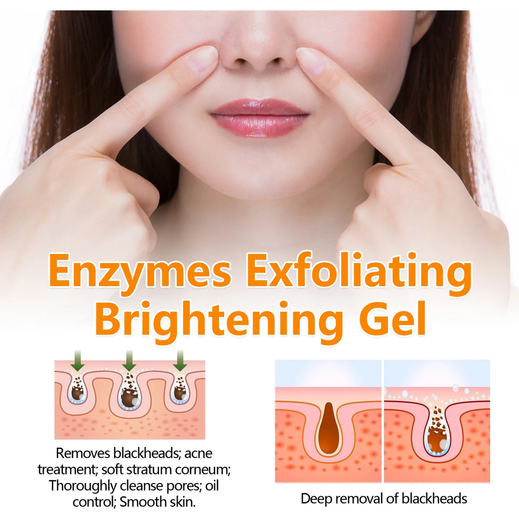 Hoygi Enzyme Exfoliating Gel – Salicylic Acid & Blackhead Remover Exfoliating Face Gel Zpaxo