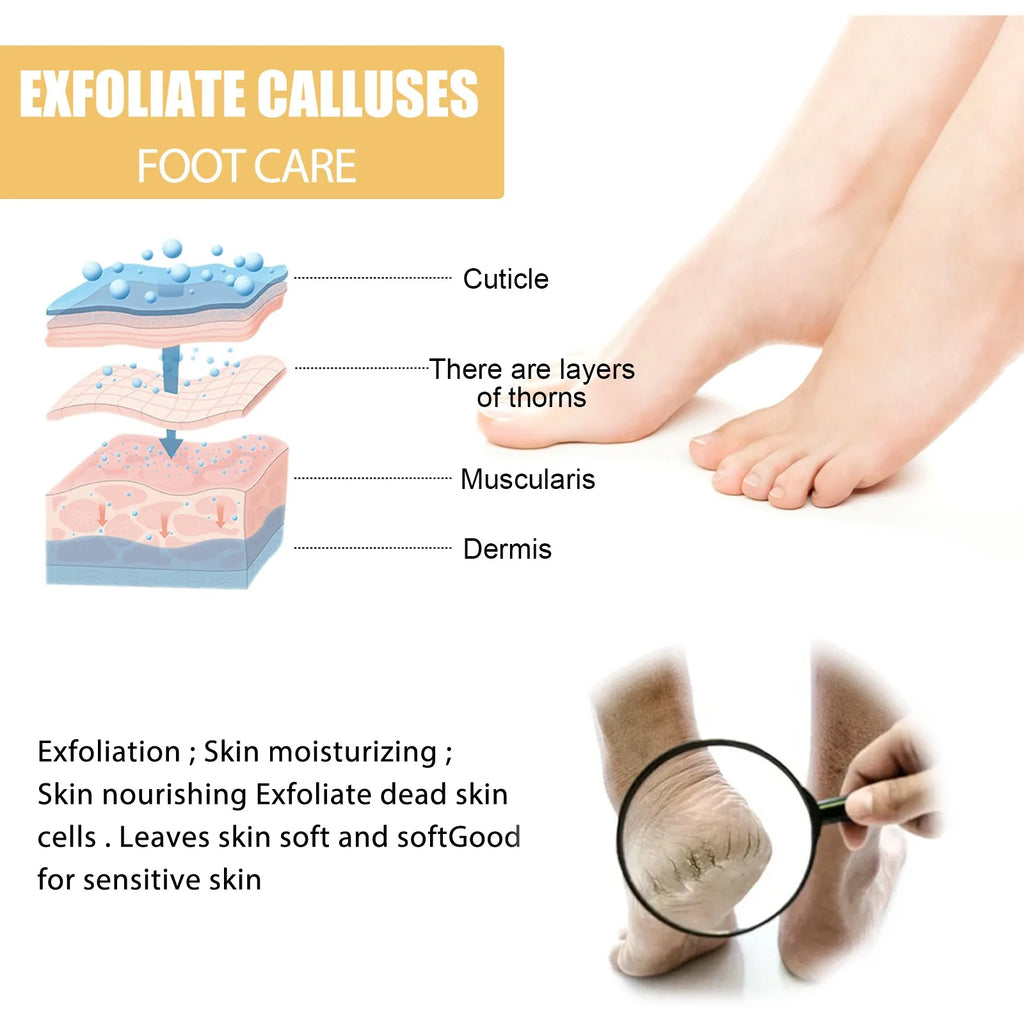 Foot Exfoliating Spray – Dead Skin, Callus & Odor Remover 200ml Foot Exfoliating Spray Zpaxo