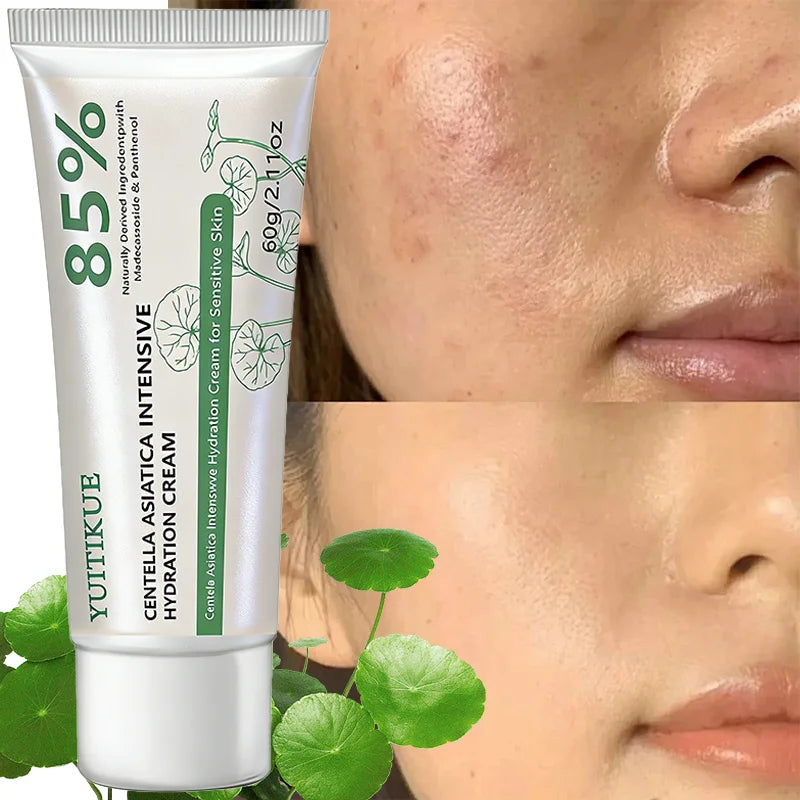 YUITIKUE Centella Asiatica Hydration Cream | Sensitive Skin 60g Face Moisturizer Cream Zpaxo