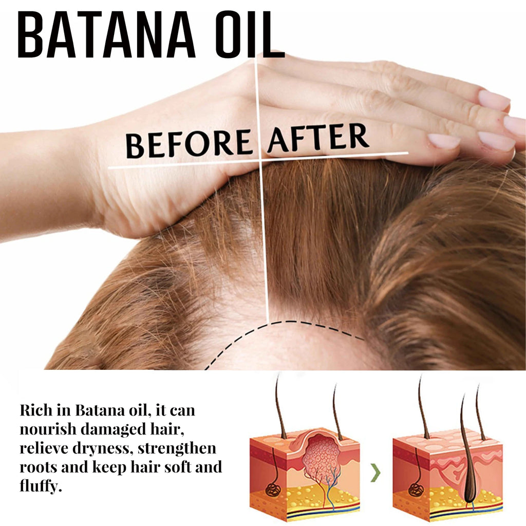 Jaysuing Natural Batana Oil Hair Spray Anti Hair Loss Hair Care Promotes Hair Growth Suitable for Men and Women Hair Conditioner Zpaxo