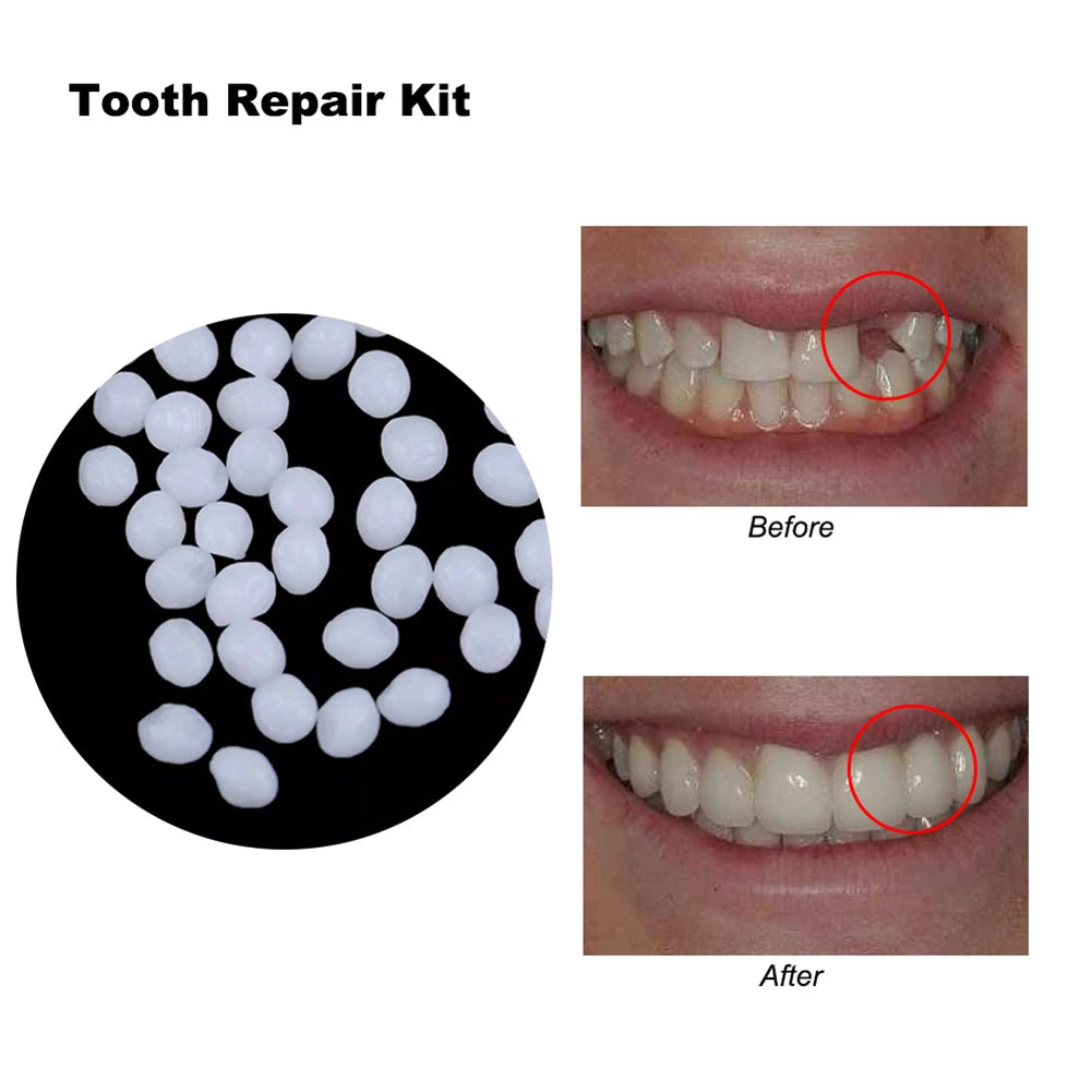 10 DIY Dentures Teether Temporary Solid Cavity Plugging Glue