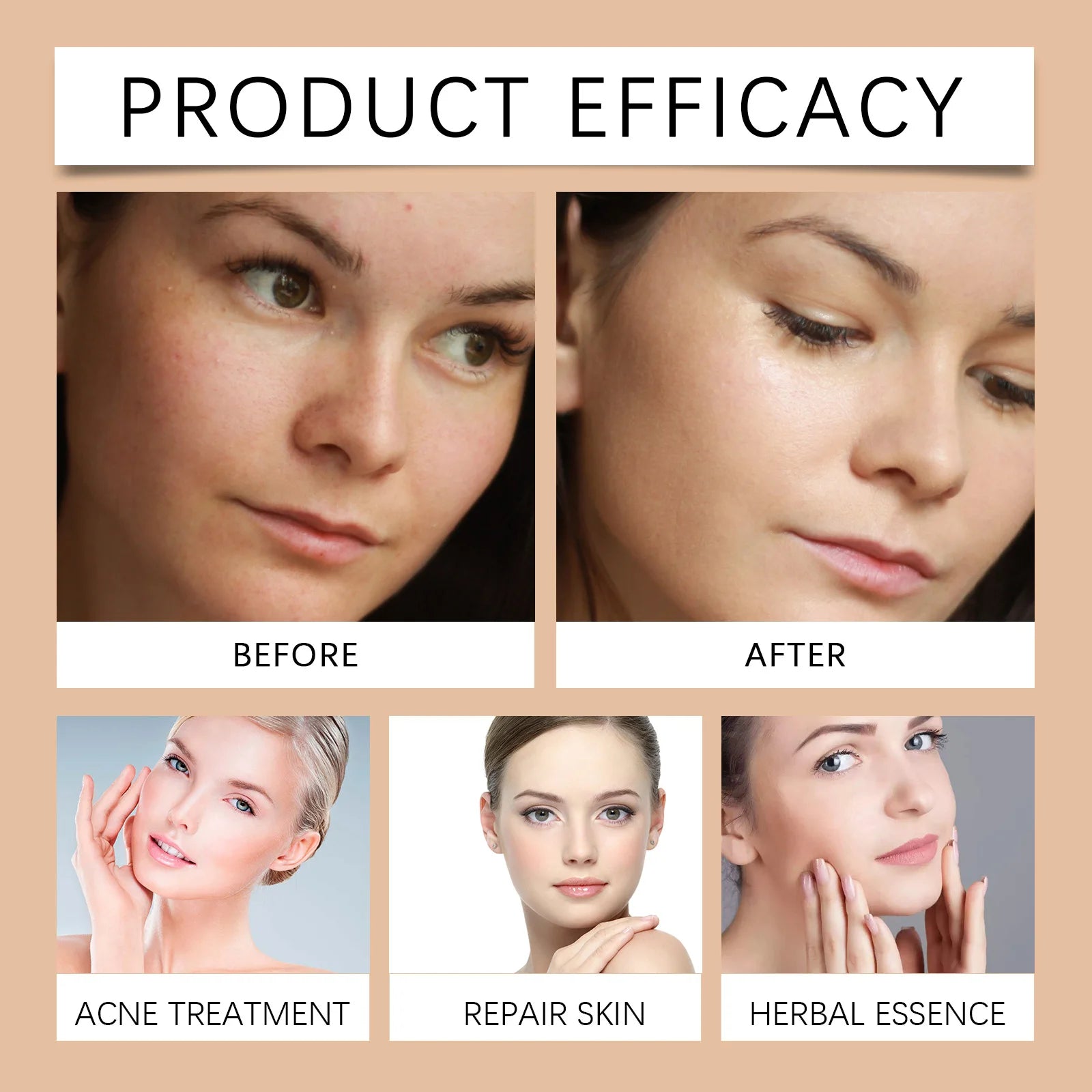 Salicylic Acid Pore Toning Lotion for Oily Clear Skin Exfoliates Gently Unclogs Pores Hydrates Without Drying 100ml Non Drying Zpaxo